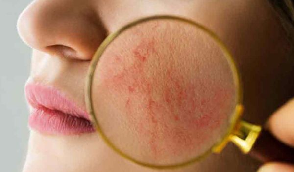 آشنایی با بیماری های پوستی رایج و درمان های آن ها – بررسی 8 نکته مهم