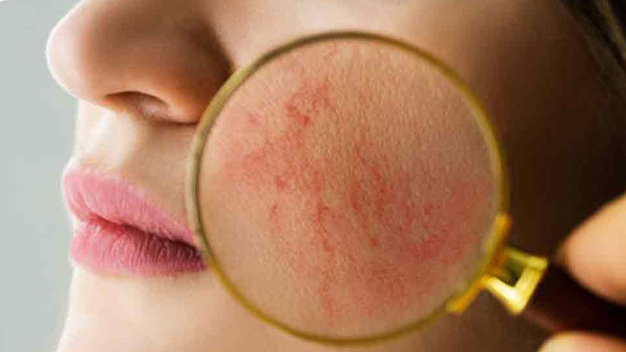 آشنایی با بیماری های پوستی رایج و درمان های آن ها – بررسی 8 نکته مهم