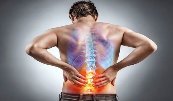دلایل و درمان کمر درد از خفیف تا مزمن – بررسی 5 نکته مهم