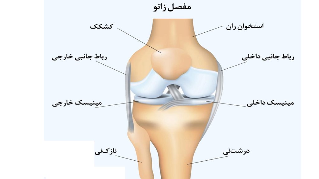 درمان آسیب مینیسک زانو – بررسی ۳ نکته مهم