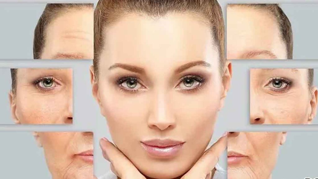 لیفت صورت با نخ – بررسی ۴ نکته مهم