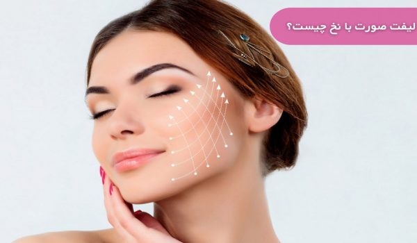 لیفت صورت با نخ – بررسی ۴ نکته مهمر
