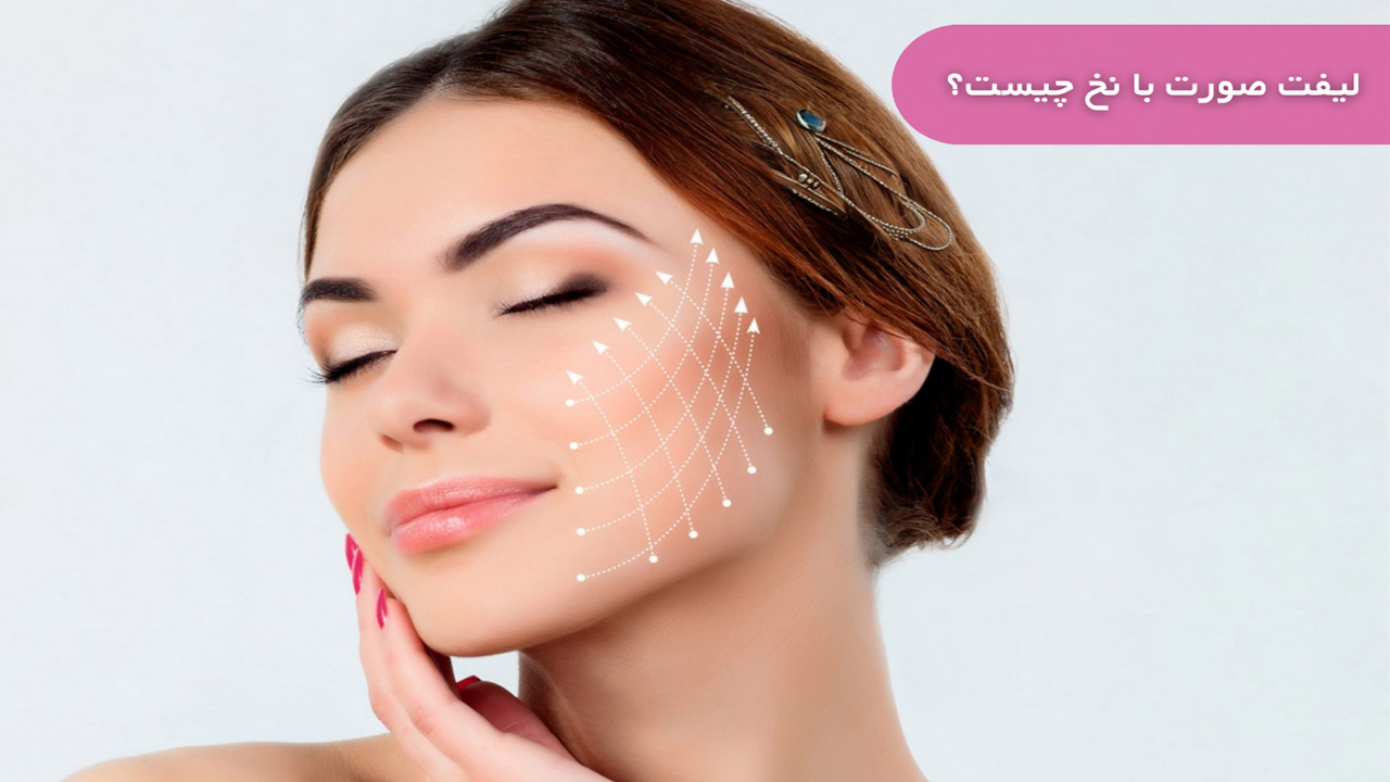 لیفت صورت با نخ – بررسی ۴ نکته مهمر