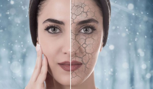 درمان خشکی پوست در زمستان – بررسی 4 نکته مهم